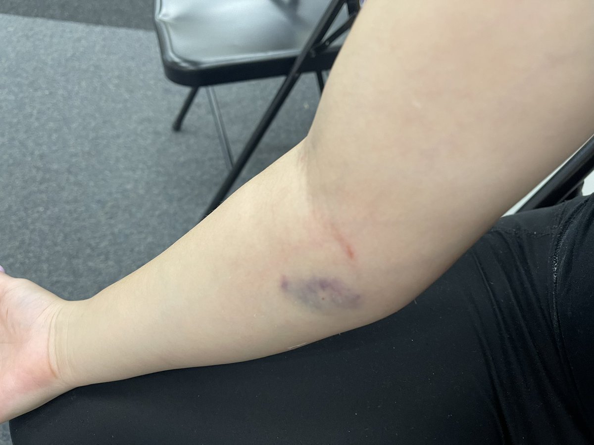 xoxforeign's tweet image. DO NOT GO TO @MedStarHealth IN OLNEY. MEDSTAR MONTGOMERY HAS THE WORST PATIENT CARE. NURSES TALK SHIT ABOUT THEIR PATIENTS. INSTEAD OF HELPING A FULL ER, YOUR NURSES ARE FLIRTING WITH SECURITY GUARDS OUTSIDE. PT1