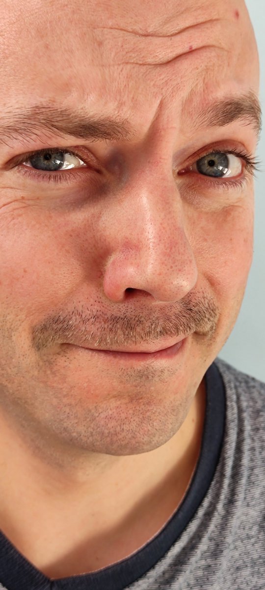 FabienMousset's tweet photo. Bref #Movember Jour 5 !

Une moustache pour sensibiliser à la santé des hommes qui meurent prématurément : cancer masculin, suicide, conduites à risque,...

Se faire dépister, parler. Pour vivre plus vieux et en bonne santé ! https://t.co/uLVrDuFzel