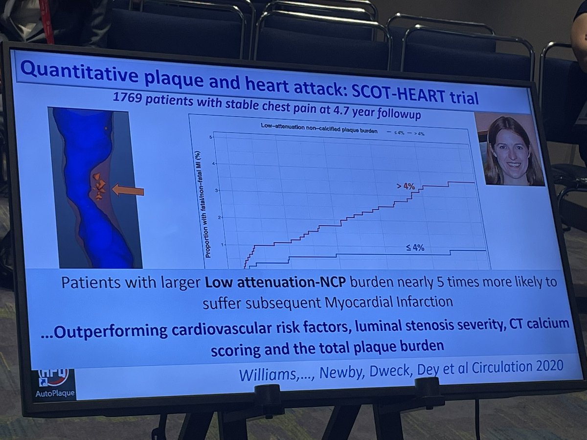 Malamo Countouris (@malamo512) on Twitter photo How does coronary plaque differ by sex? Expert <a href="/damini_dey/">Damini Dey</a> relaying key points. Low attenuation plaque may be more predictive among women ! How does coronary plaque differ by sex? Expert <a href="/damini_dey/">Damini Dey</a> relaying key points. Low attenuation plaque may be more predictive among women !