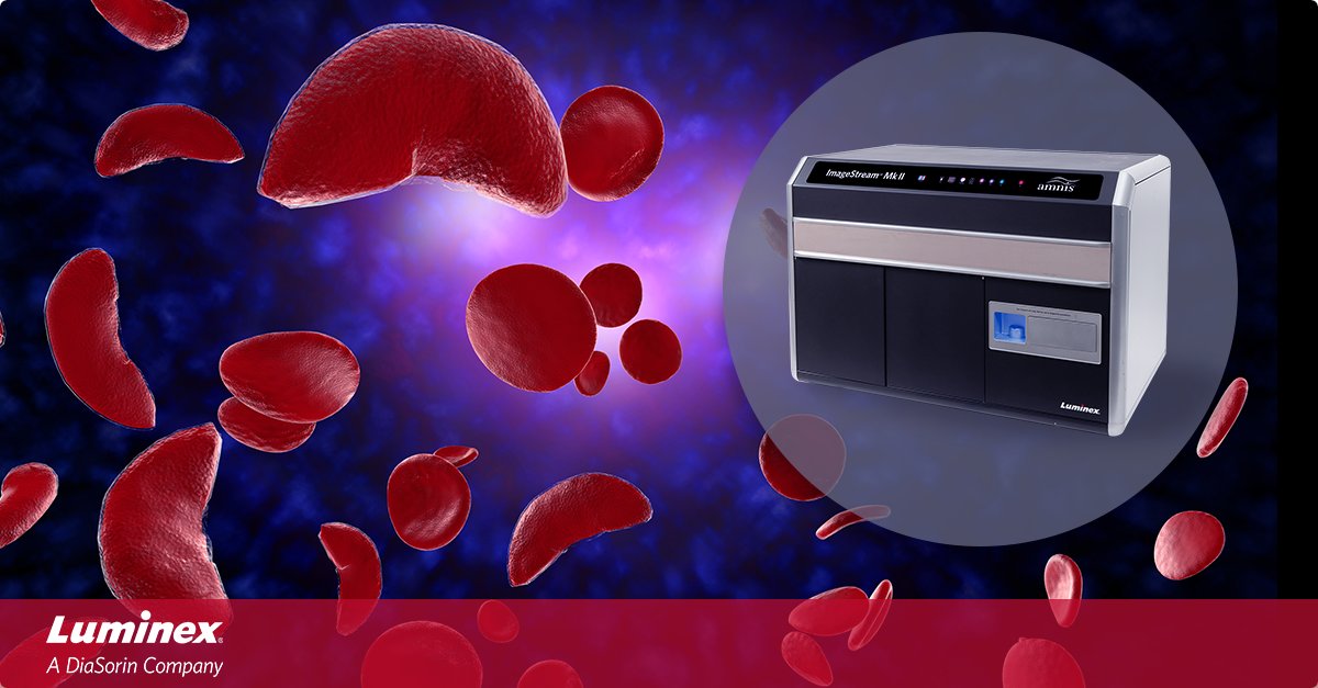 Luminex's tweet image. Uncover the dynamics between RBC #sicklecells &amp;amp; parasites. Join us for a webinar presented by Divya Beri, PhD November 10th, 11am ET for a visualization of parasite growth under hypoxic &amp;amp; hyperoxic conditions in sickle RBCs using #ImageStream.
 
hubs.li/Q01qYqnT0