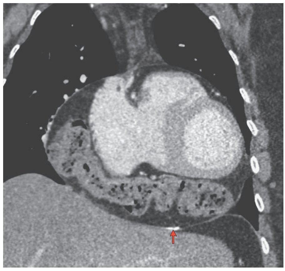 Oren Gottfried MD On Twitter A 54 year old Woman Presented With oren-gottfried-md-on-twitter-a-54-year-old-woman-presented-with