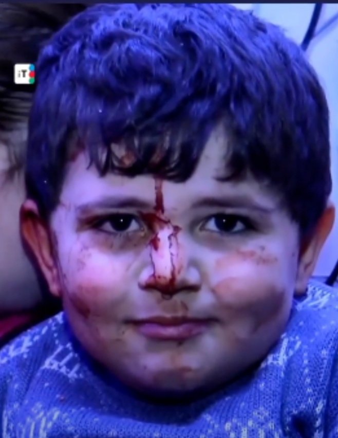 Victory begins with the belief.  It was such a belief that in spite of  the blood on his head and face, young Omar Nasirov smiled confidently and courageously at the cameras though  he was pulled out from under the building  which was destroyed  in Ganja
#Zəfərinamdanbaşlayır