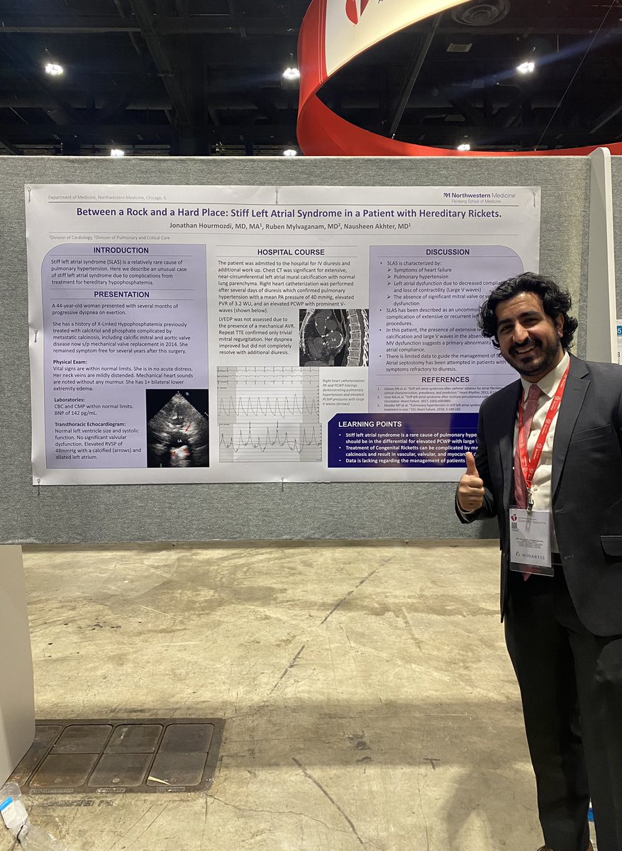 Nausheen Akhter, MD (@nakhtermd) on Twitter photo Have you heard of ‘stiff left atrial syndrome’ from hereditary hypophosphatemia? Check out our awesome <a href="/WeAreNUHeart/">WeAreNUHeart</a> fellow <a href="/JHourmozdi/">Johnny Hourmozdi</a>’s poster on this challenging case of pulmonary HTN! <a href="/MylvaganamRuben/">Ruben Mylvaganam</a> <a href="/NMCardioVasc/">NM Cardiovascular</a> <a href="/NM_Lung/">NM Pulmonary and Thoracic Surgery</a> #AHA22 Have you heard of ‘stiff left atrial syndrome’ from hereditary hypophosphatemia? Check out our awesome <a href="/WeAreNUHeart/">WeAreNUHeart</a> fellow <a href="/JHourmozdi/">Johnny Hourmozdi</a>’s poster on this challenging case of pulmonary HTN! <a href="/MylvaganamRuben/">Ruben Mylvaganam</a> <a href="/NMCardioVasc/">NM Cardiovascular</a> <a href="/NM_Lung/">NM Pulmonary and Thoracic Surgery</a> #AHA22