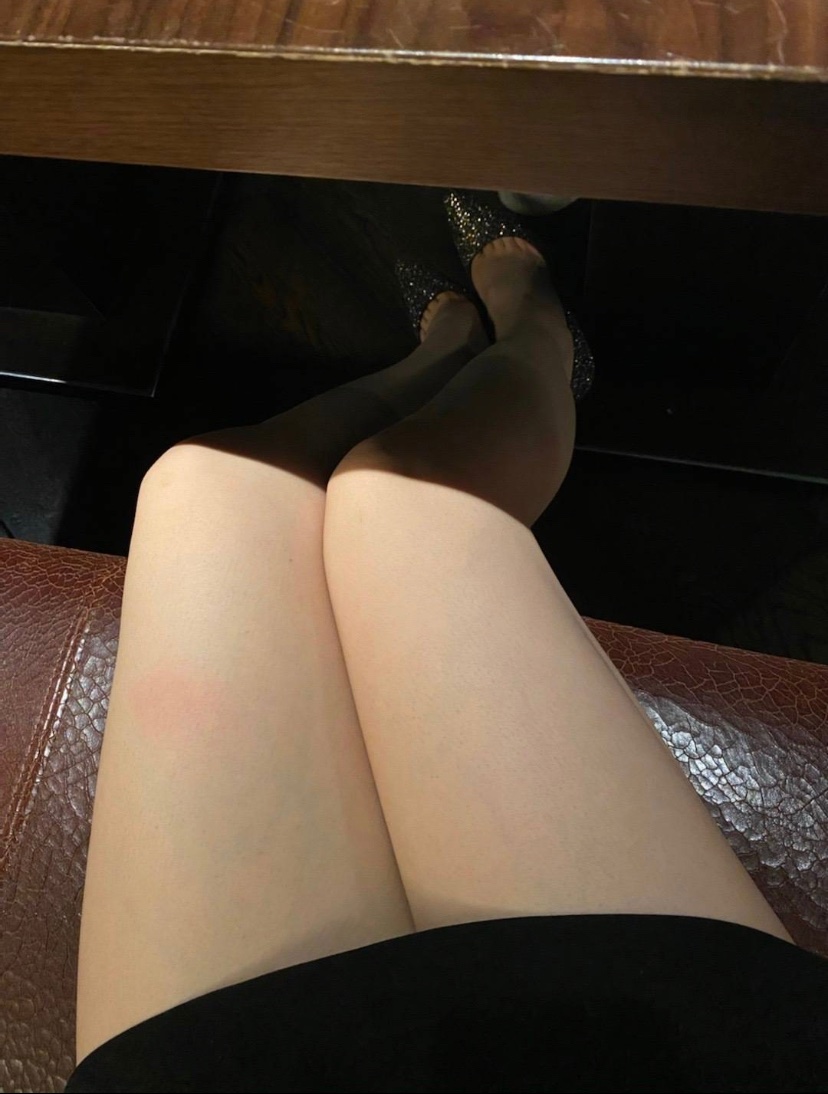 露个腿给大家看～