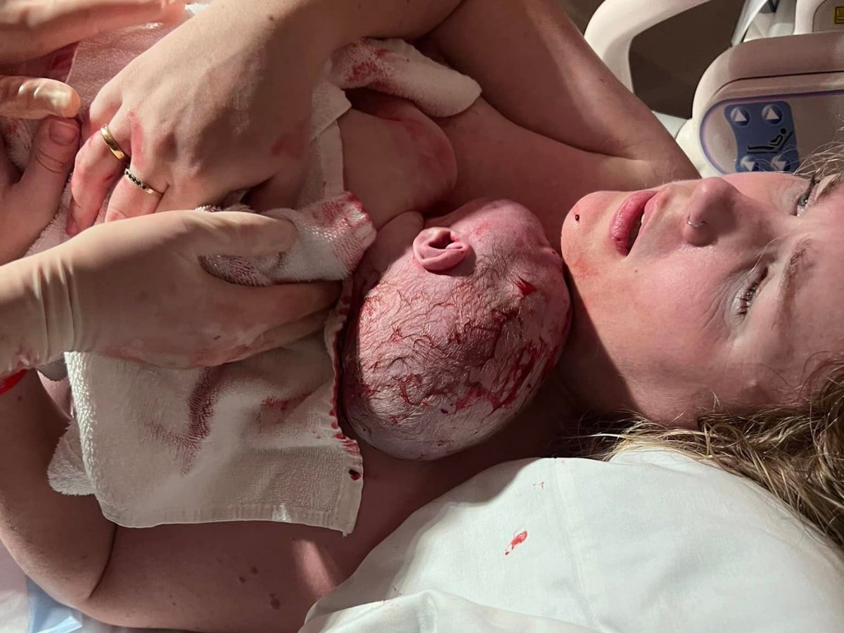 BirthInternatio's tweet image. Successful VBA2C, just shy of 18 months after my 2nd caesarean birth - After an incredibly fast and intense two-hour labour.

📑 Read more story here: birthinternational.com/category/birth/.

#VBACsuccess #VBACwithoutfear birthinternational.com/category/birth…