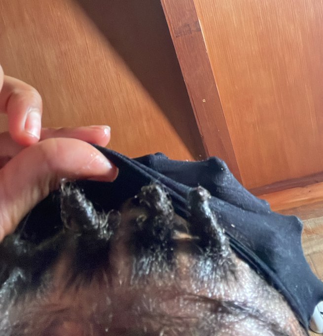 😭😭😭 Bro they in bantu knots. This all yall getting cause ion even know if they gone turn out right 😂🤞🏽