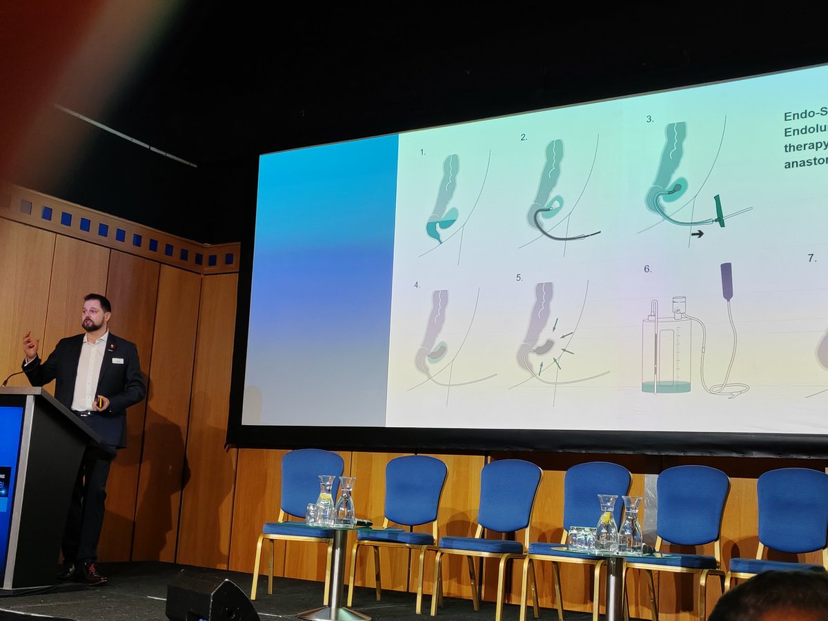ALRSGBandI's tweet photo. Platinum lecture by @BBraunUK on use of Endo-SPONGE technology for treatment of anastomotic leak. #ALS2022 https://t.co/LLJiynZU38