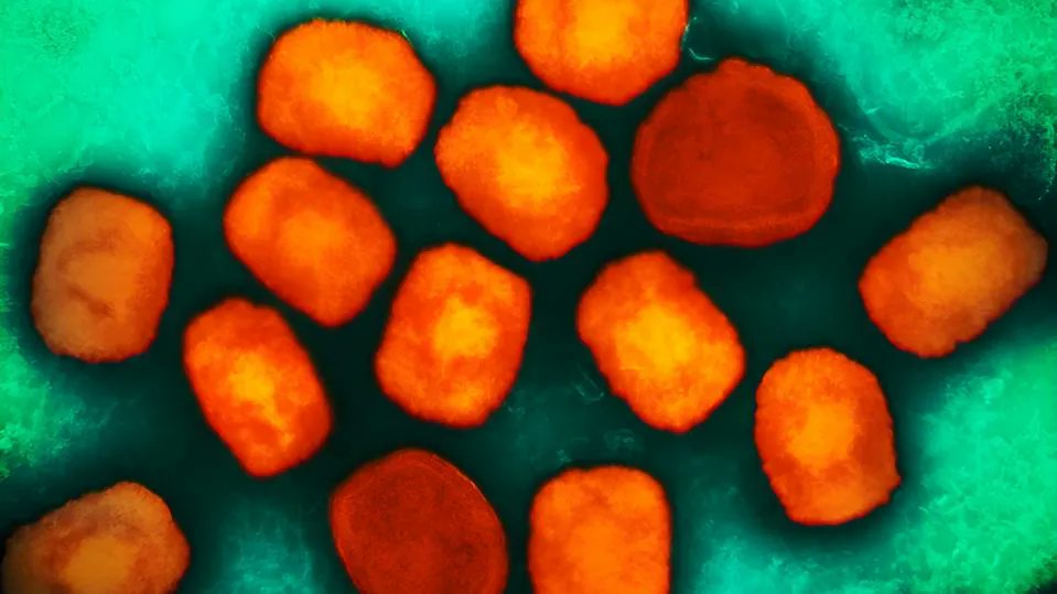 BiotechSweden's tweet photo. Scientists Warn Dangerous Monkeypox Variant Circulating In Central Africa Could Fuel New Outbreaks https://t.co/5F01LdEC0t https://t.co/1qsyWs03Hz