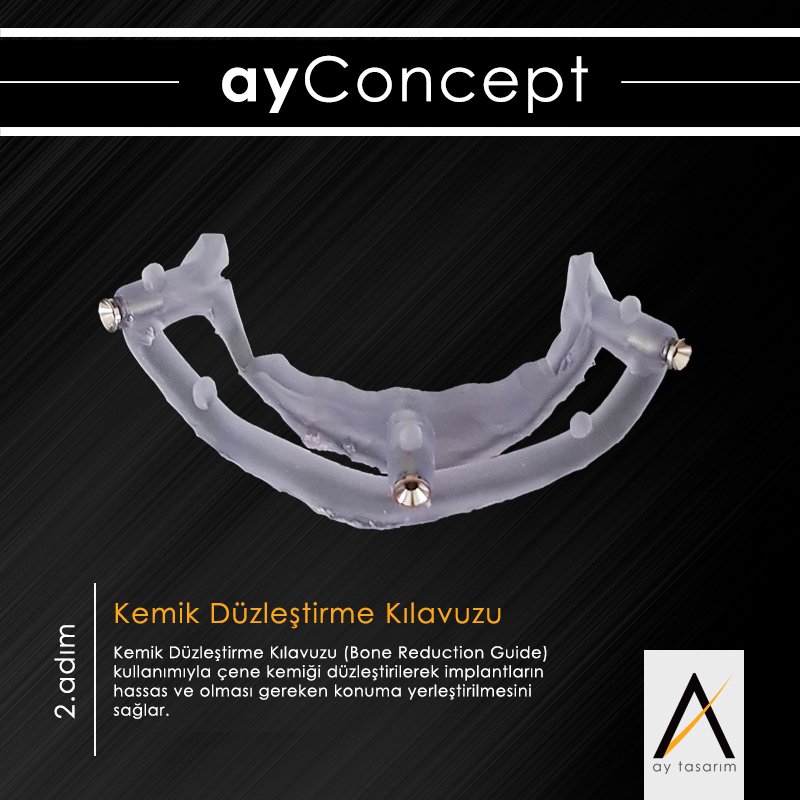 aytasarim's tweet photo. ayConcept Katmanlı Rehber Sistemi 🔥
🔴 ayConcept Katmanlı Cerrahi Kılavuzları ile, komplike implant operasyonlarınız ve restorasyonlarınız artık çok daha basit ve güvenli. https://t.co/E5ubiVHzby