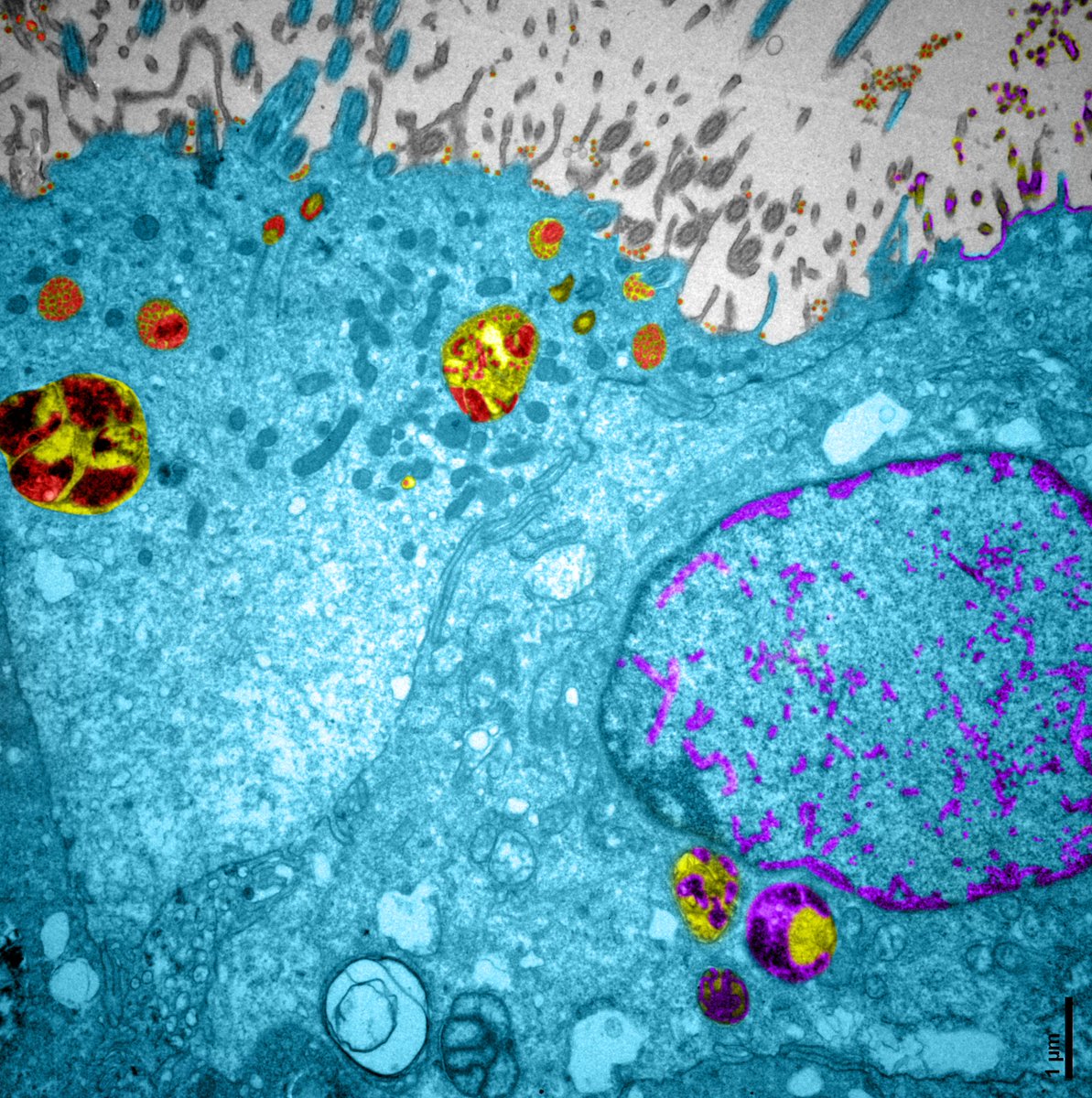 (1/4) <a href="/VirNextFR/">VirNext - Expert en virologie</a> is offering in vitro preclinical models of respiratory virus-virus co-infections.

To learn more, don’t hesitate to contact us or visit our website to see VirNext offers !

contact@virnext.fr
virnext.fr

#SARSCoV2 #influenza #microscopy #Virus #RSV