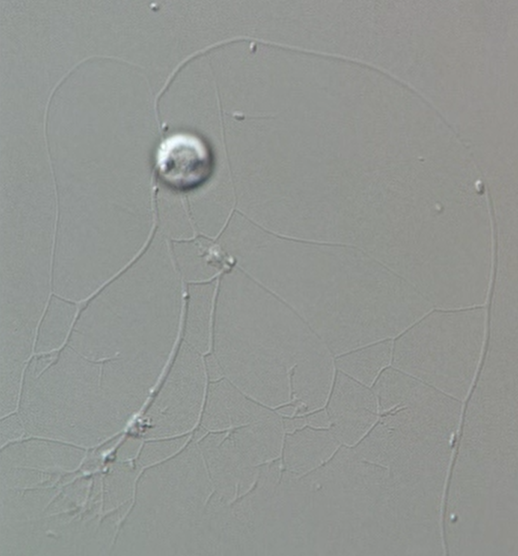 Meet the #Kraken! This #amoeba has a tiny cell body of around 7µm in diameter, but the extensive web of #pseudopodia can cover up to 1 mm in size! It uses it to feed on #bacteria. See the video here: kennethdumack.de/Kraken_feeding…