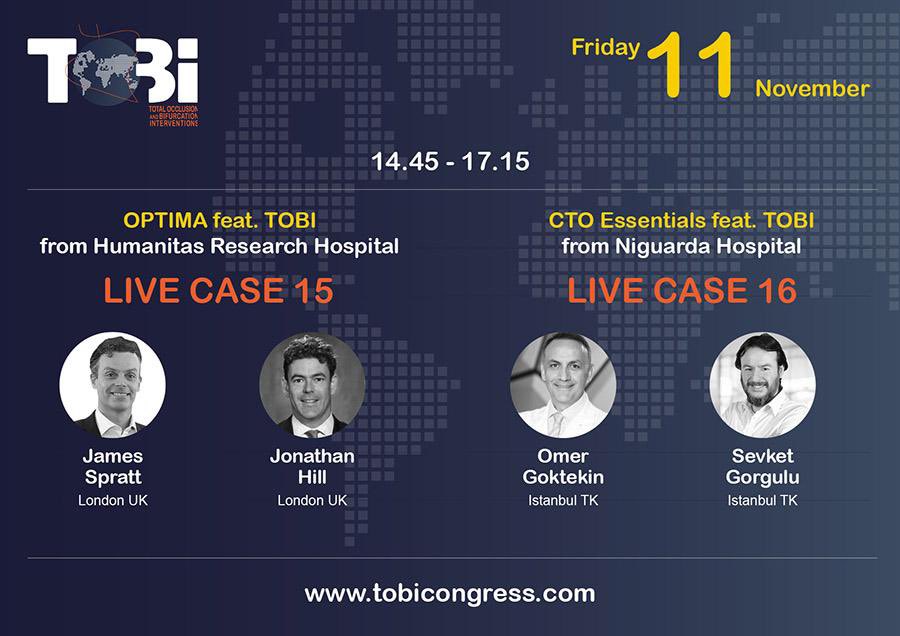 Together with my dear friend Şevket Görgülü, we are in Milan for total occlusion and bifurcation meeting (TOBI). We will be doing a live case broadcast on behalf of  CTO ESSENTİALS group.  I am very honored to be at this important meeting.