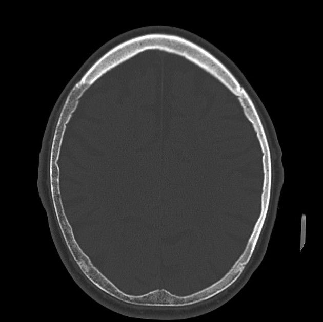 Radiology Signs on Twitter: