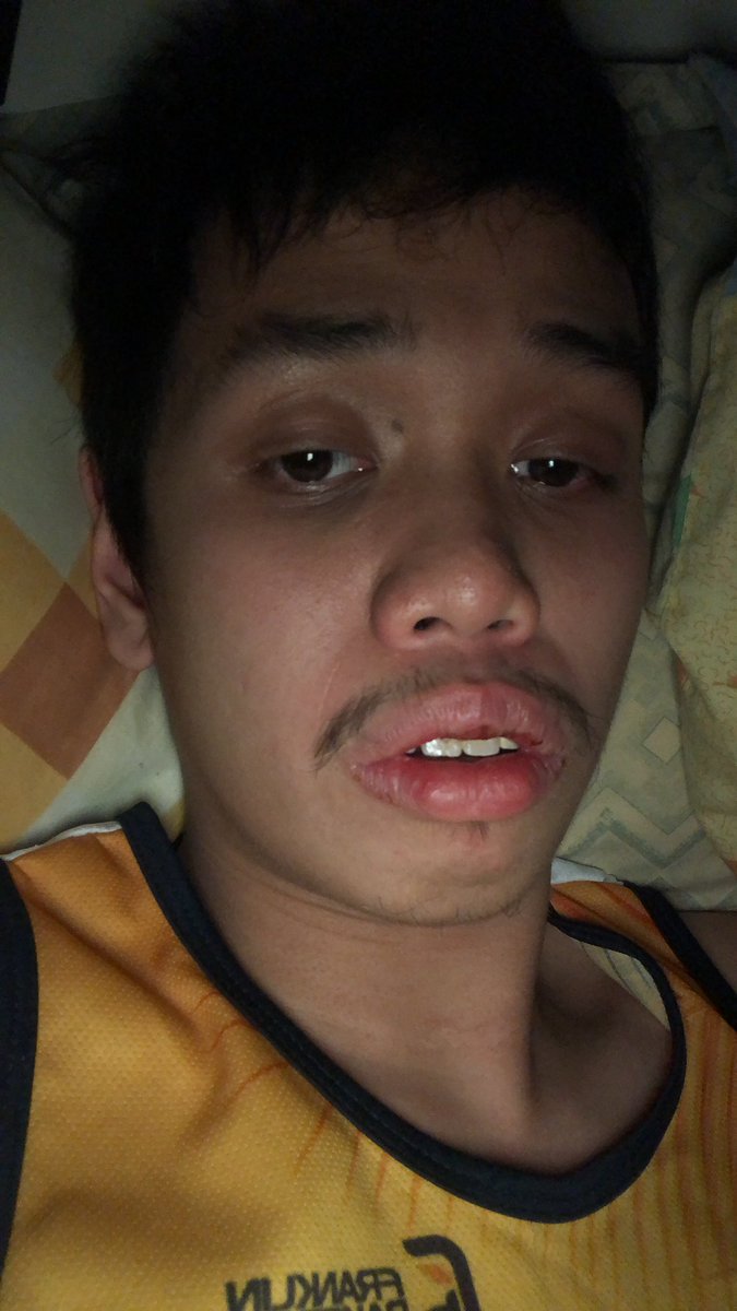 Ranpoy1Yap's tweet image. Hi mga katropie may lanat ako sa #pienightlong kasi may sakit at ubo ng ulo ate @Karen_Bordador #aaronmaniego @heyimrenee @iampieofficial #PIEChannel