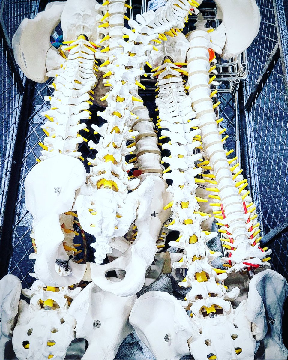 UOSPhysio_'s tweet photo. Next on the Human Anatomy &amp; Clinical Science 1st year Physiotherapy module - the Lumbar Spine 🤓💙🦴 #physiostudent #Physiotherapy #physio 
To find out about our Physio degree &amp; innovative block learning approach @UniofSuffolk click here https://t.co/p5K8fx7bp9 https://t.co/RxDTN8Yr63