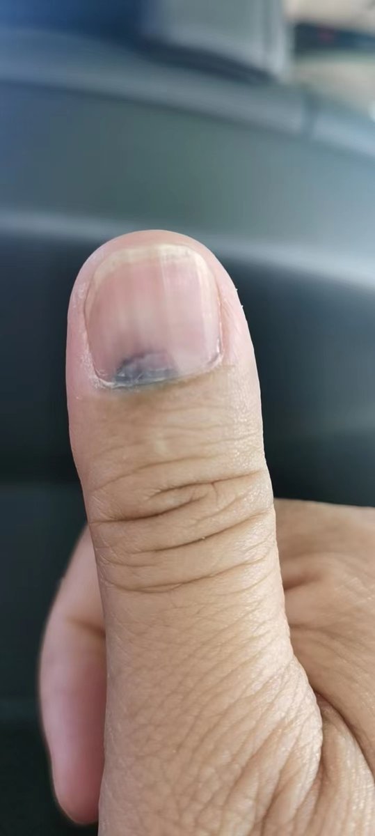 NND,一事不顺，诸事不顺。