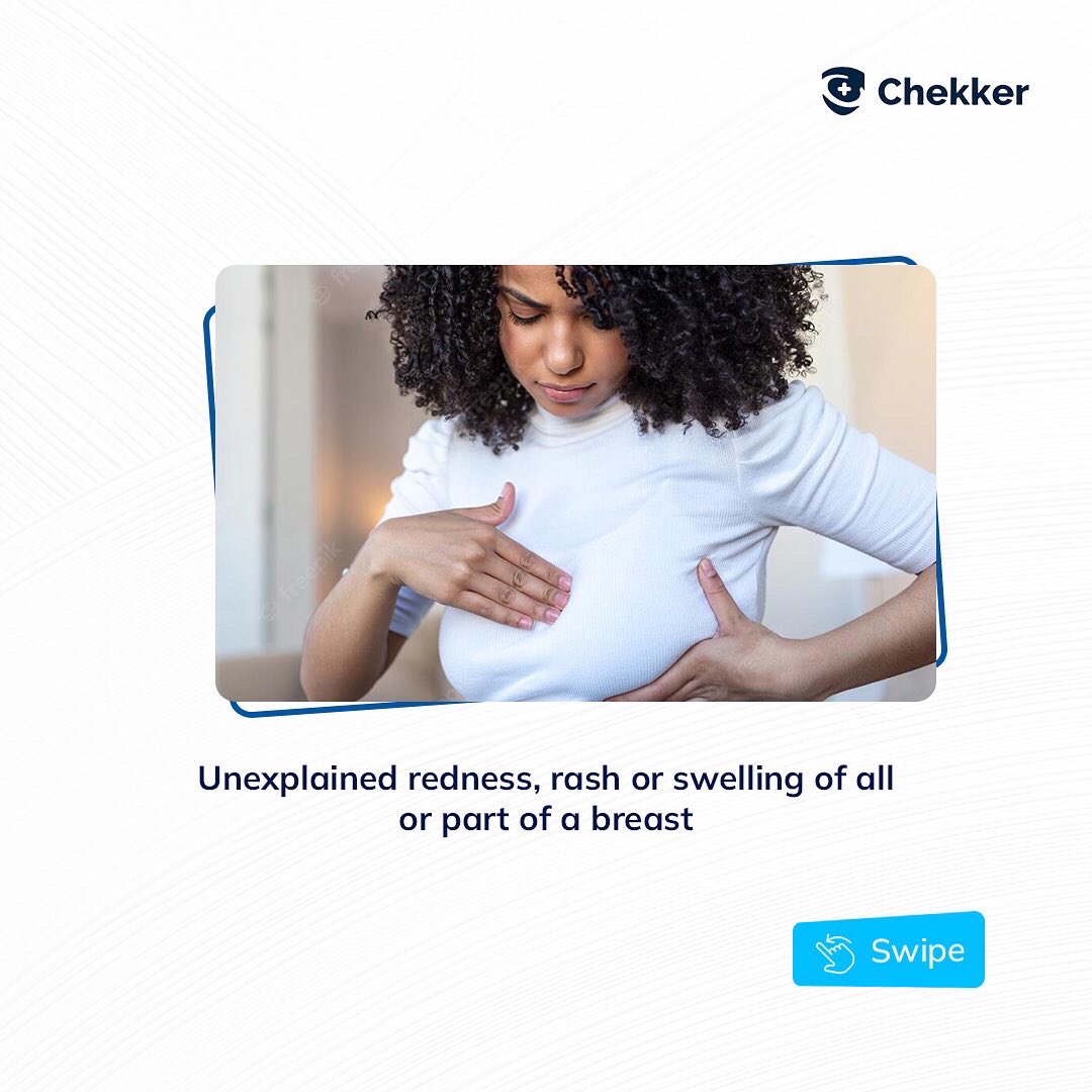 Mychekker's tweet photo. This means it's also important for you to know what your breasts normally look and feel like, so you’ll be aware of any changes in your breasts.
Here are some of the symptoms of breast cancer.
#BookATestWithChekker #BreastCancerAwareness https://t.co/HnaVqEuwPY