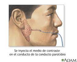 Alberto_zafiro's tweet photo. - Sialografía: Consiste en el estudio radiológico de los conductos de las glándulas salivales mayores, el cual, utiiza radiación ionizante y contraste. (Esta en Desuso). https://t.co/n7AcmEEfrc