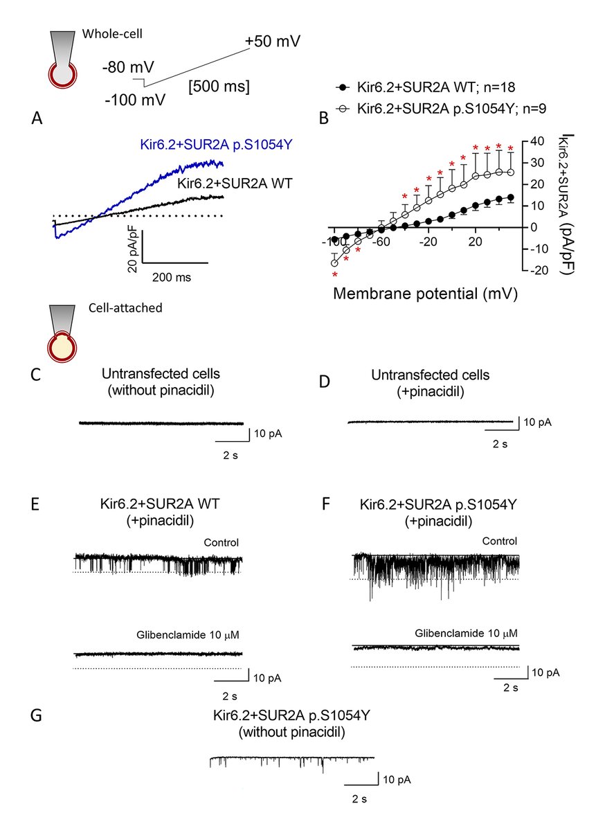 Journal of General Physiology (@jgenphysiol) on Twitter photo Crespo-García, Rubio-Alarcón, Delpón, Caballero et al. <a href="/unicomplutense/">Complutense</a> show that the Cantú syndrome–associated p.S1054Y SUR2A mutation increases open probability and conductance of ATP-sensitive (KATP) channels bit.ly/3sx8m5X
#CellularPhysiology #Biophysics Crespo-García, Rubio-Alarcón, Delpón, Caballero et al. <a href="/unicomplutense/">Complutense</a> show that the Cantú syndrome–associated p.S1054Y SUR2A mutation increases open probability and conductance of ATP-sensitive (KATP) channels bit.ly/3sx8m5X
#CellularPhysiology #Biophysics