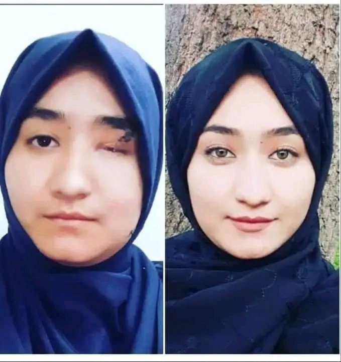 Rahmatinoori's tweet photo. همدلی از هم زبانی بهتر است! 
#StopHazaraGenocide 
برای زخمیان مرکز آموزشی #کاج شفای عاجل و صحتمندی کامل از بارگاه حضرت حق استداعامندم! 
الهم اشفی کل مریض 👐👐 https://t.co/zHKo0cNuuF