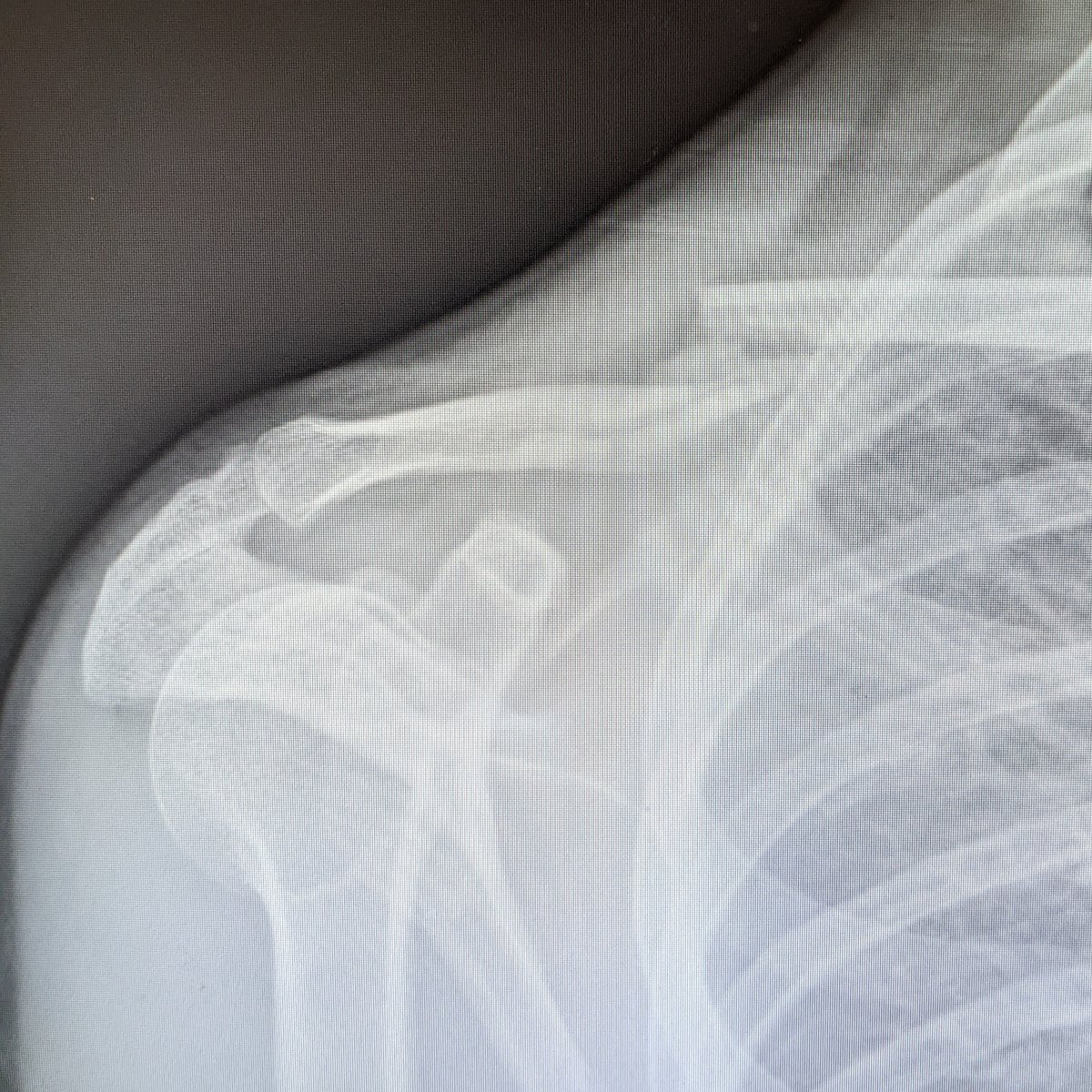 Mark Buntaine tweet media