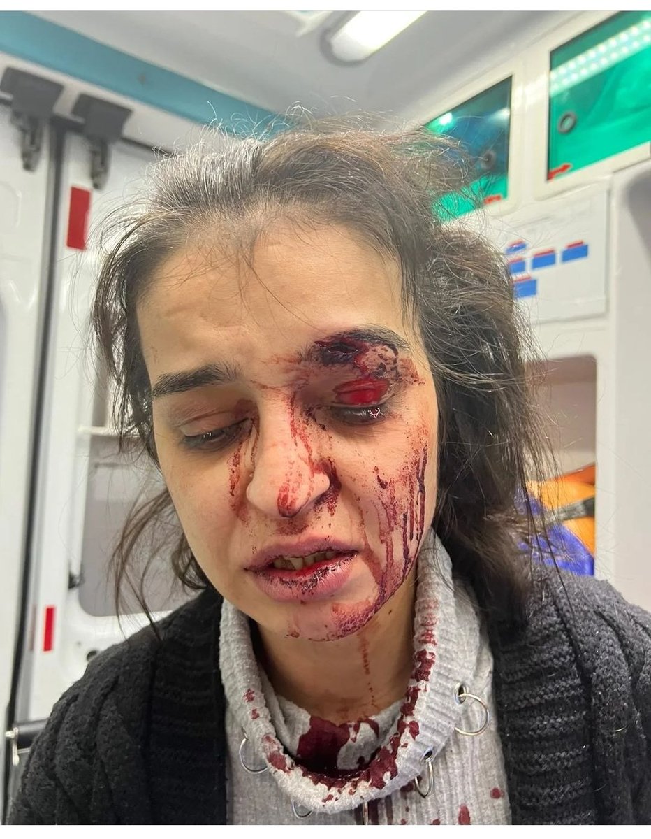 figen_kucukcal's tweet photo. #benöldüktensonragelecekadaletiistemiyorum #kadınaşiddet #yalnızdeğilsin #ilkim #sesverin #benölmeistemiyorum #yanındayız #yanındayızsefo https://t.co/PlxklPOTEt
