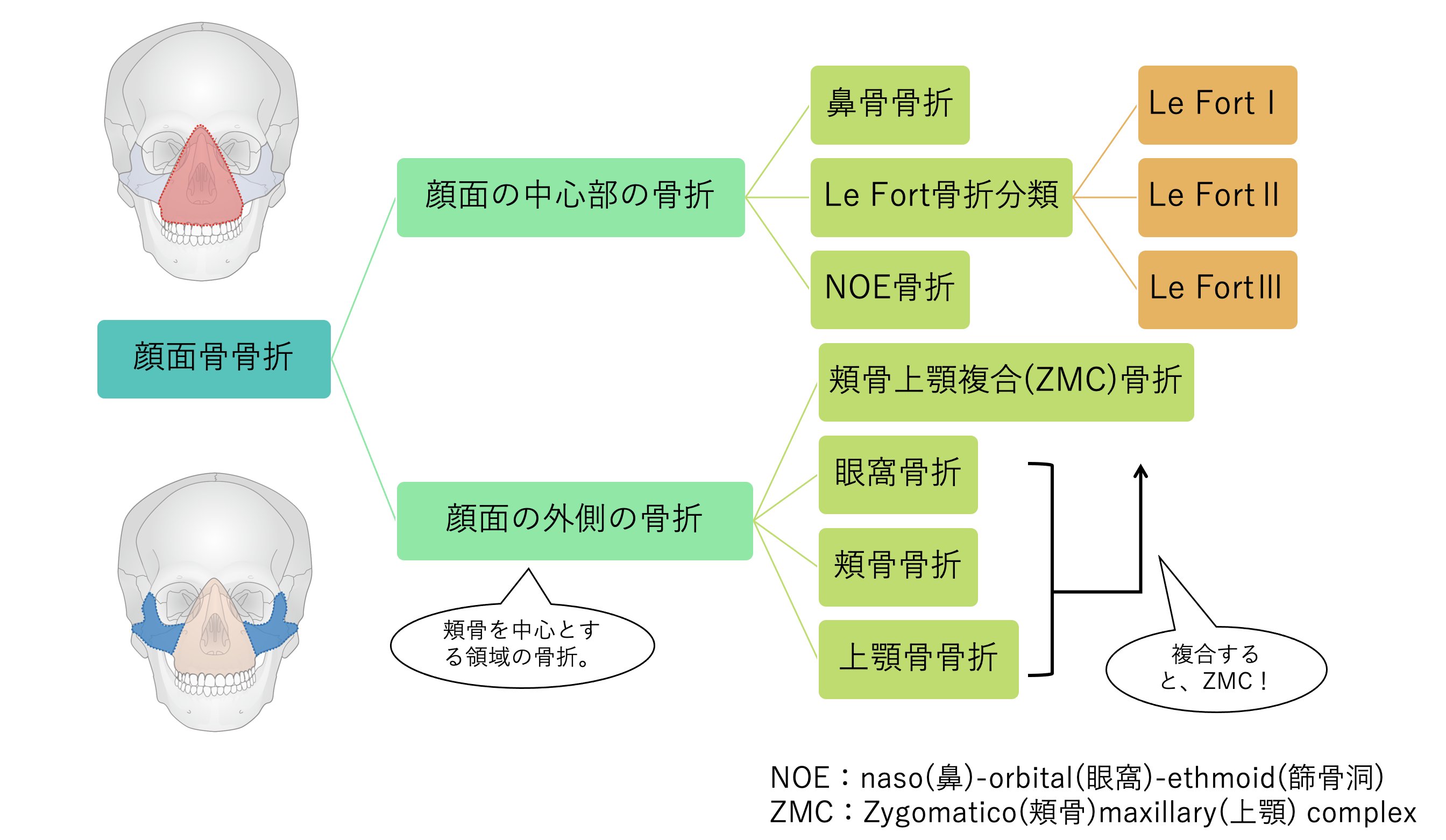 顔面骨骨折の治療の実際【電子版】 | 医書.jp