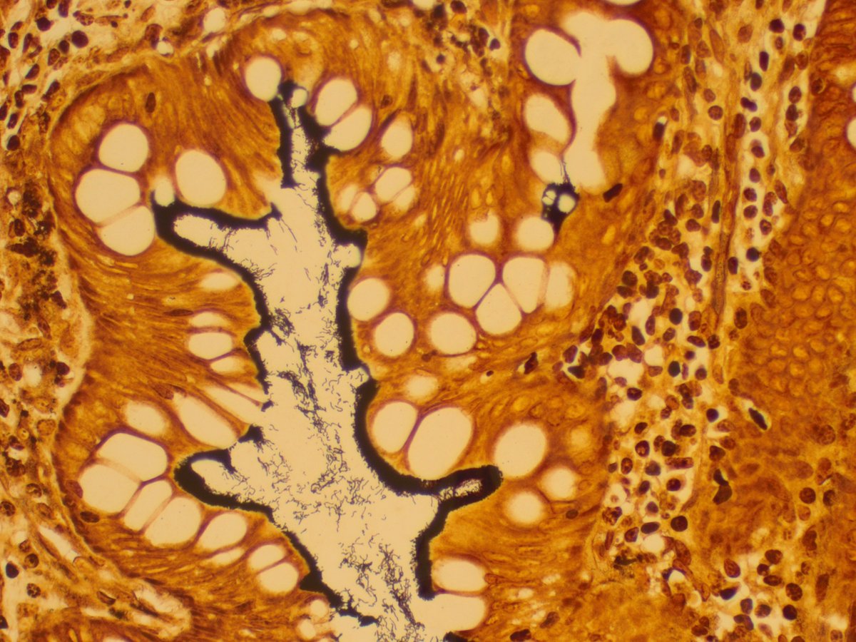 @MCWPathology tweet media