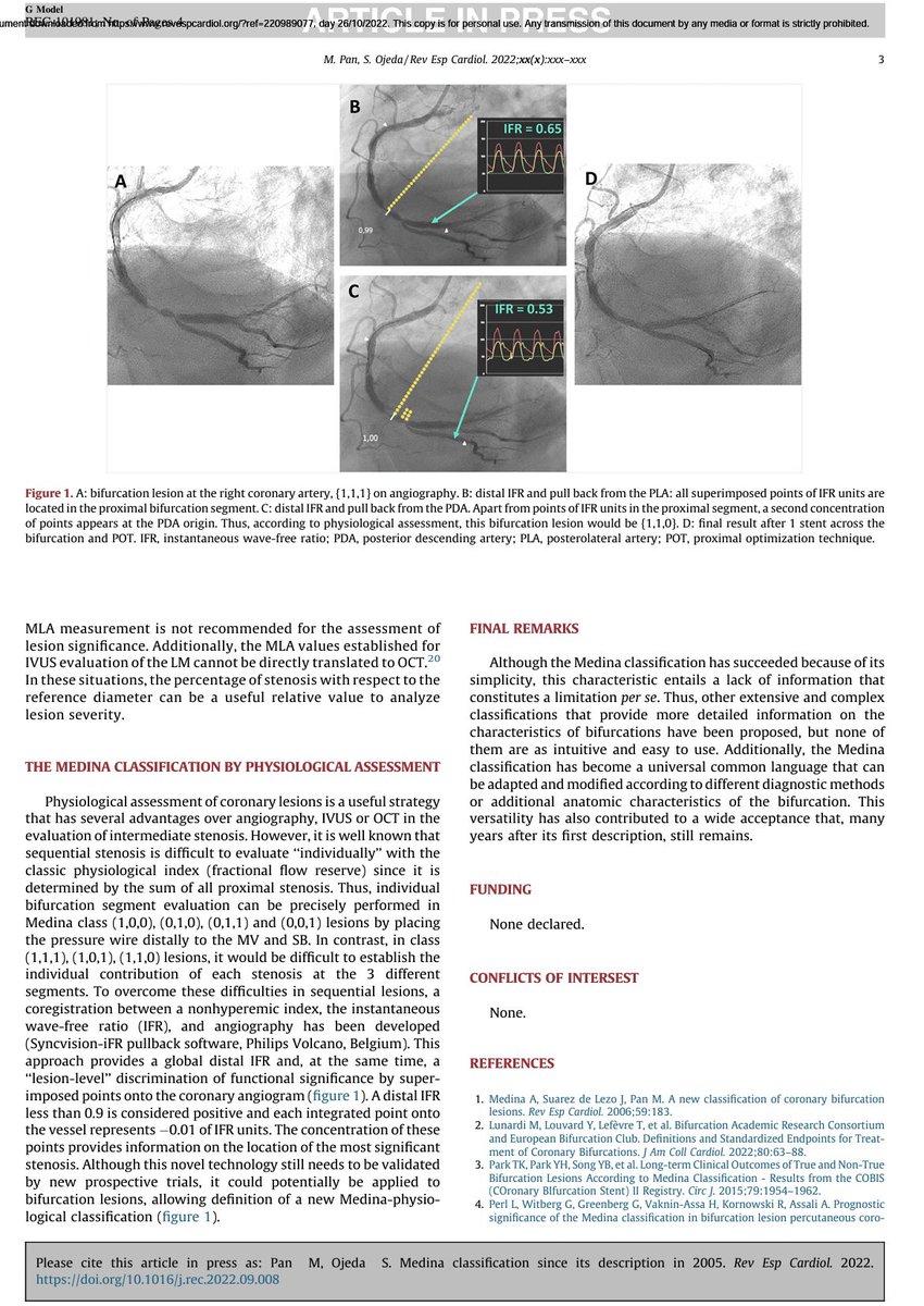 MPAOSS's tweet photo. Medina classification succeeded by simplicity, but today has become an universal language that can be adapted/modified according to diagnostic methods or additional anatomic characteristics of the bifurcation. @GoranEBC @belcid7 @LAzzaliniMD @NievesGonzalo1 @CuissetDr @PCRonline https://t.co/CxzscZi0Bu