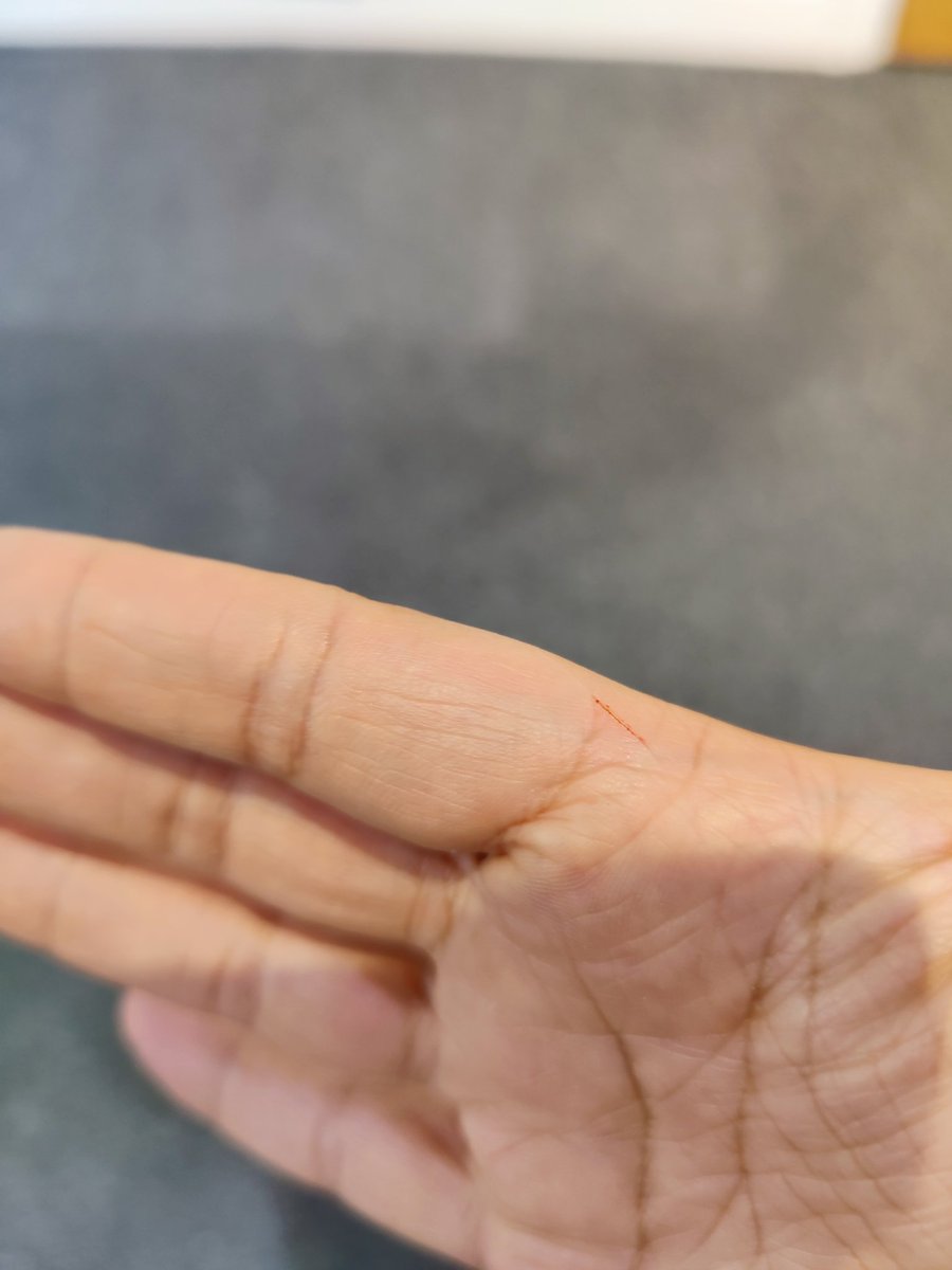 EditorASNews's tweet photo. Sympathy wanted. Deadly paper cut. ๐ฅ
I'm taking tomorrow off sick lol ๐
#lowpainthreshold https://t.co/MbaV0PLVu1
