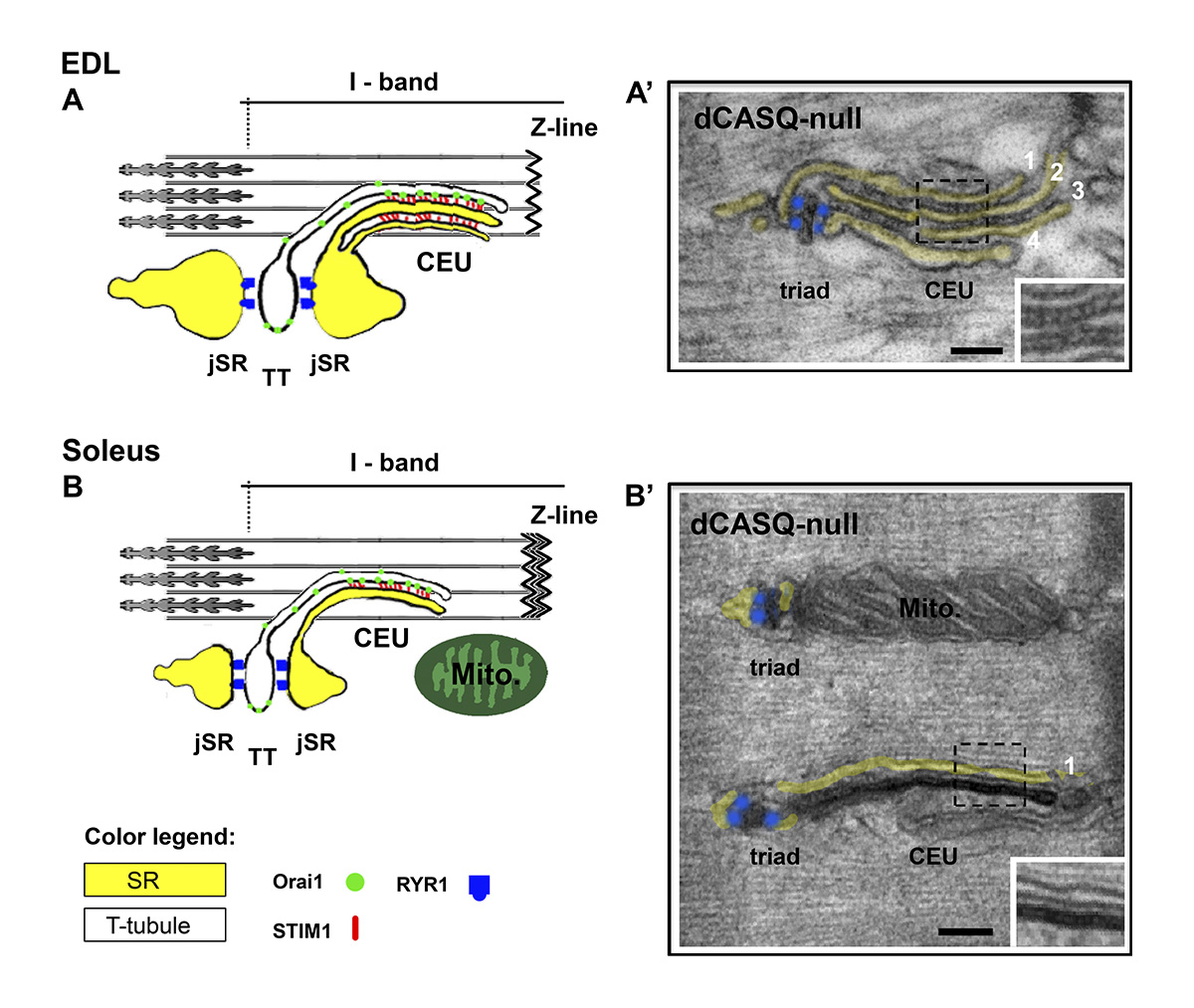 JGenPhysiol's tweet photo. Comparative models of Ca2+ entry units (CEUs) in EDL and soleus muscle fibers from WT mice and representative EM images of CEUs in EDL and soleus fibers from calsequestrin-null mice. From Michelucci, Boncompagni and colleagues @univUda: https://t.co/i5CkWCjgdS
#ECCoupling https://t.co/cGNUHJKb9O