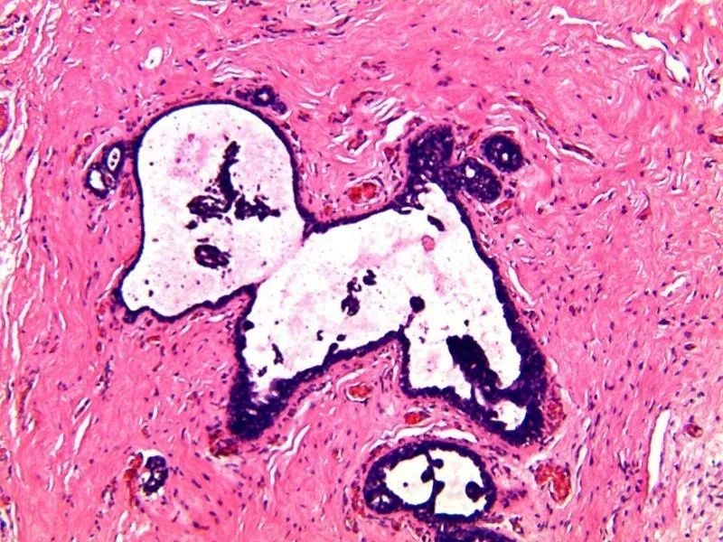 tiki_shi's tweet photo. To embrace the world of pathology is to embrace the world of art
#pathologyart
#pathologyimage
#digitalpathology https://t.co/8SHAdTkhO7