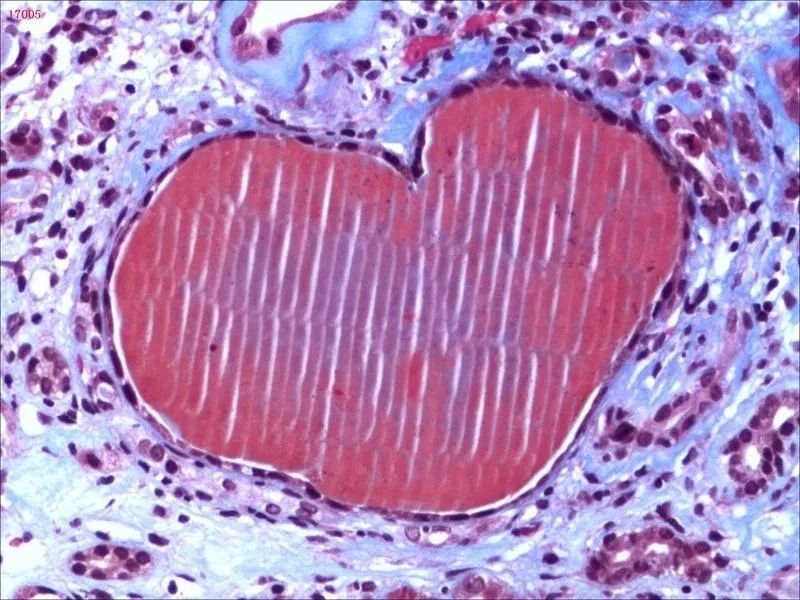 tiki_shi's tweet photo. To embrace the world of pathology is to embrace the world of art
#pathologyart
#pathologyimage
#digitalpathology https://t.co/8SHAdTkhO7