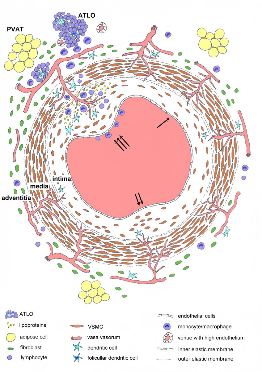 bjbms's tweet photo. Pathogenesis of atherosclerosis in the tunica intima, media, and adventitia of coronary arteries: An updated review
Read more at: https://t.co/jnqRjSOl6Q
#pathology #review #atherosclerosis #coronaryartery #BJBMS https://t.co/102nO2vMei