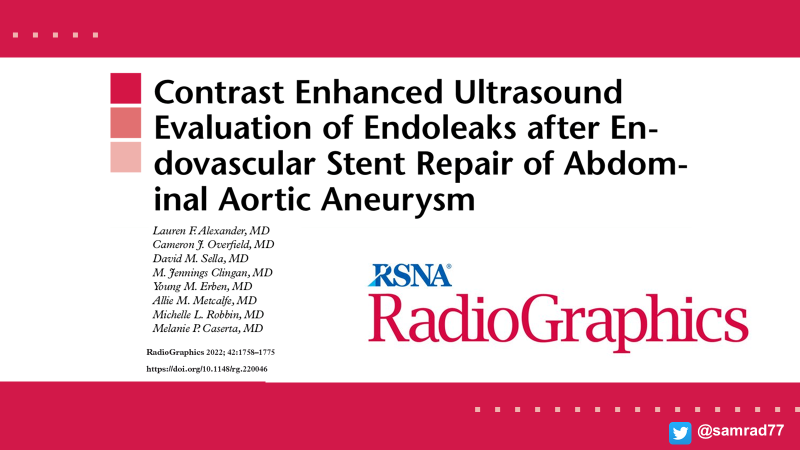 samrad77's tweet photo. Thanks for coming along on the journey!  Check out the incredible full-length @RadioGraphics article by Dr. Alexander, @ErbenYoung, @DrOverfieldMD, and @mpcaserta with plenty of tips and useful information, and videos. 

Link: https://t.co/cPuhfiGwiv
#RGphx @cookyscan #tweetorial https://t.co/Vj2IJI3aF6