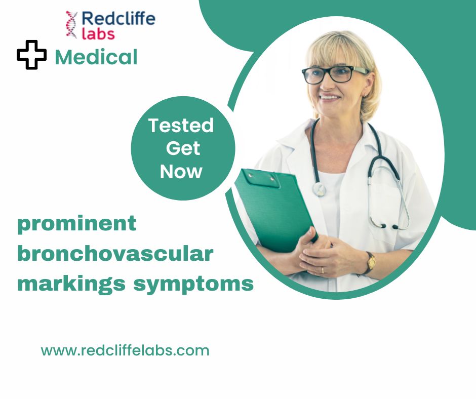 RedcliffeLabs1's tweet photo. Prominent Bronchovascular Markings in Chest X-Ray Report: All you need to know - MyHealth

If your chest X-ray report shows prominent bronchovascular markings symptoms

https://t.co/IzHTMlDOEK https://t.co/zX2XAc20dM