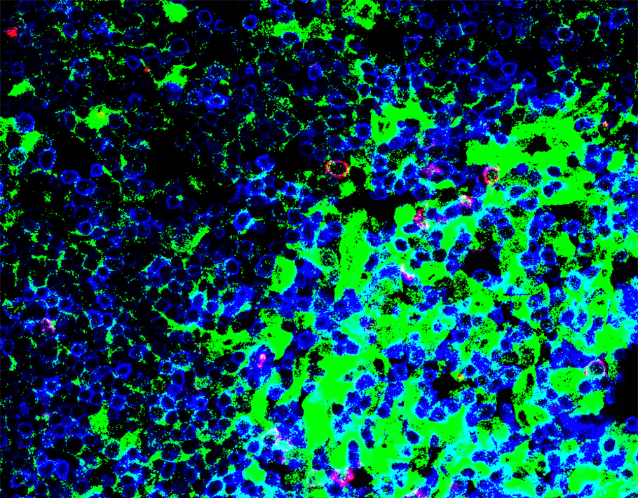 New <a href="/SciImmunology/">Science Immunology</a> research in mice presents a previously unknown subset of iNKT cells can control cancers, such as melanoma, and viral infections, including influenza. 

📄: scim.ag/k8