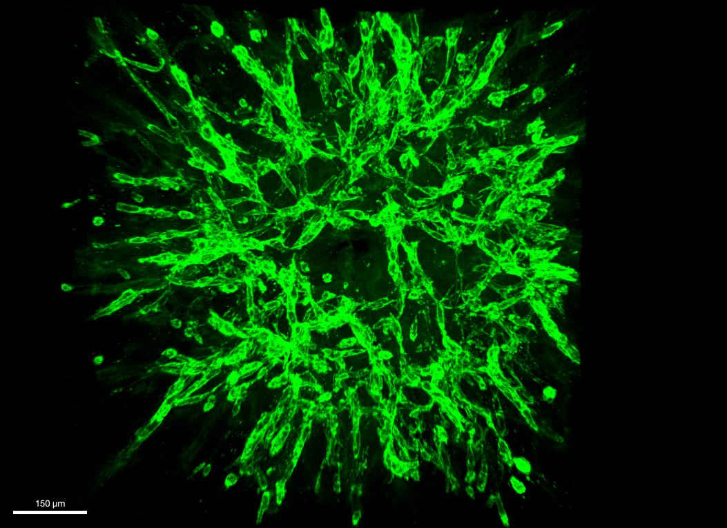 ⚠️PhD opportunity⚠️ We are recruiting a #PhD student to join our dynamic lab who will use #stemcells to generate 3D #organoids to investigate #vascular changes in children with #CKD, working with Profs David Long and <a href="/RukshanaShroff/">Rukshana</a>. Apply before 25/11/22 tinyurl.com/4bndbf4a