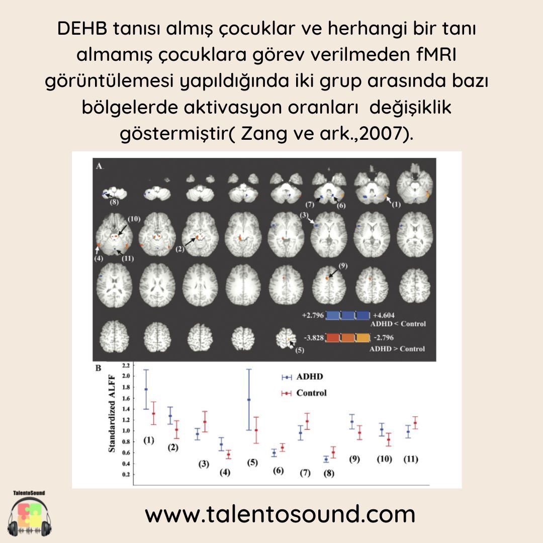 DEHB tanısı almış ve almamış iki grup çocukla yapılan fMRI çekimlerinde farklılıklar olduğu gözlemlenmiştir. Gönderi üzerindeki resimde numaralandırılmış olan beyin bölgelerinde DEHB(ADHD) tanısı alan çocuklar ve almayanların… Devamı için -> instagram.com/p/CkNjUUKILoL/