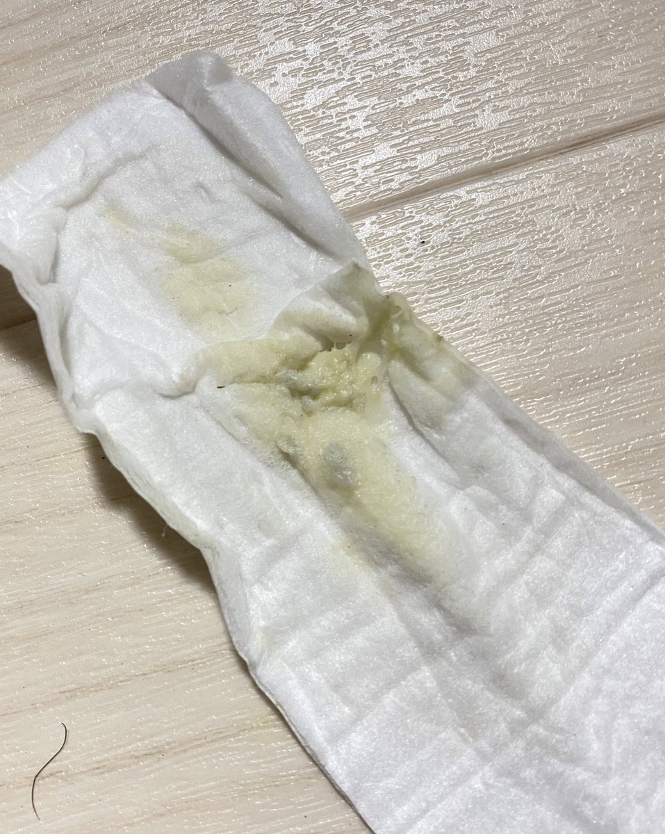 rinach310's tweet photo. セフレくんがおりものシートを舐めたら「ワキと同じ苦い味する」だって😂💦
はい、スソガです⚠️☺️
今���も今日とて強烈なにおい👃
欲しい方dmくださいね〜💕

#オリシー売ります #オリシー販売 #おりものシート売ります #おりものシート販売 #下着売り子 #おりもの売ります #スソガフェチ https://t.co/pjepjobSg7