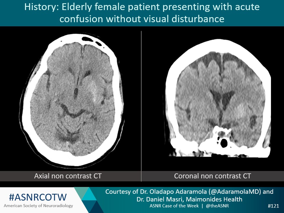 The American Society of Neuroradiology tweet media