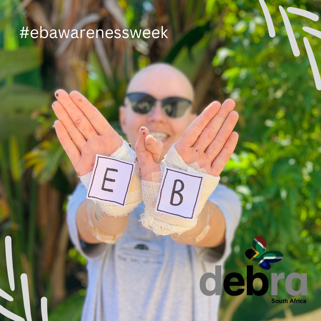 IADPO's tweet photo. It's #EBAwarenessWeek2022, dedicated to increasing awareness of the painful genetic skin condition, #EpidermolysisBullosa (EB). 🦋 EB, also known as 'Butterfly Skin'.

Join Debra South Africa, and share this post to raise awareness of EB, thank you. 💙

#EBAW #EBAW2022 https://t.co/GhHGCyXTQj