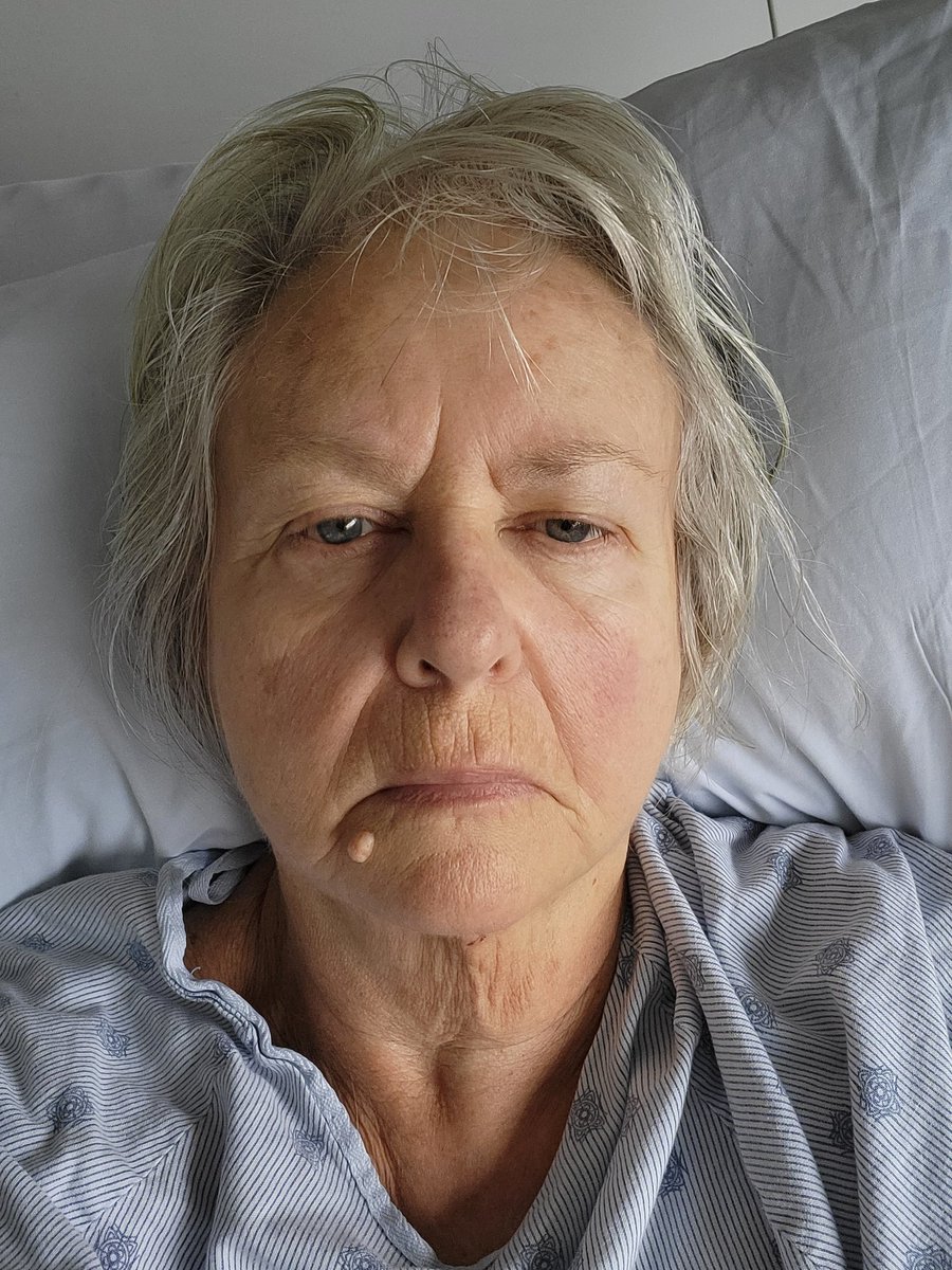 fictionophile's tweet photo. 7th day post-op, still in hospital,  but finally able to Tweet. Haven't felt up to reading. After op pain and heavy duty narcotics have stolen my reading MOJO. #bookbloggers send me some MOJO. #bookblogger #booklovers #readingmojo #CanadianBlogger https://t.co/gWfs354Xmt