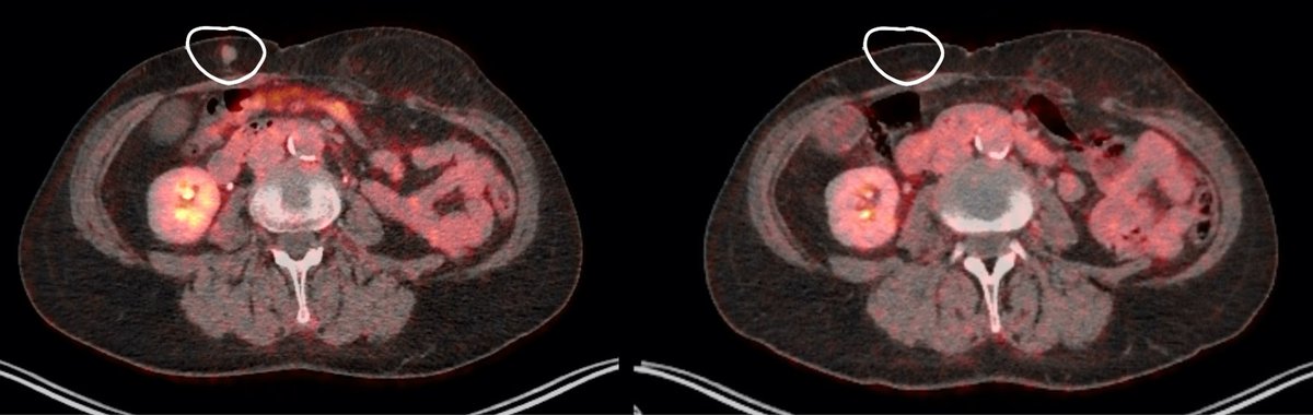 BiosynthGroup's tweet image. Biosynth are Proud to Supply Evaxion’s Phase IIb Trial for Personalized Neoantigen Peptide Cancer Vaccines 

"Proud to contribute to life-improving breakthroughs”
 Read full blog here...ow.ly/XyKL50LlrwP

@Biosynth #Evaxion