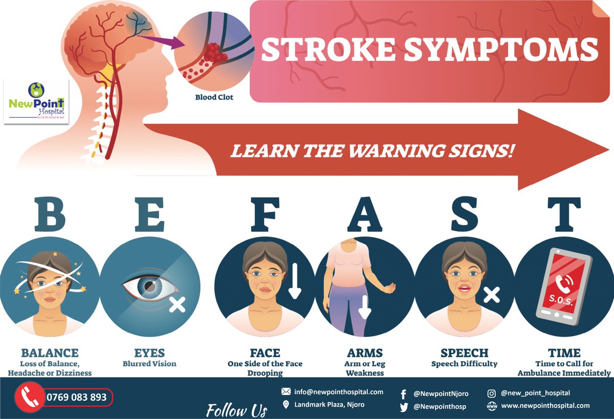 NewpointHosp's tweet photo. #stroke, sometimes called a brain attack, occurs when something blocks blood supply to part of the brain or when a blood vessel in the brain bursts. In either case, parts of the brain become damaged or die. It can cause lasting brain damage, long-term disability, or even death https://t.co/TE7bNgjoGM
