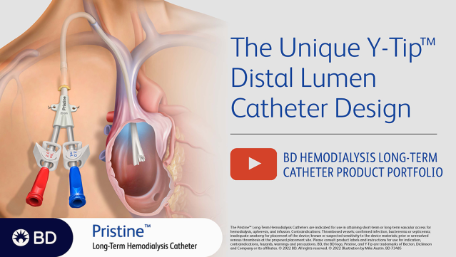 aacuna14's tweet photo. Unique design &amp; continued innovation! The Pristine™ Long-Term Hemodialysis Catheter is the first of its kind, offering a symmetric Y-Tip™ &amp; side-hole free design. Click the link below for safety info &amp; to learn more about the Pristine™... #BDemployee https://t.co/59iPUDrQU0 https://t.co/WXr7hIC8IF