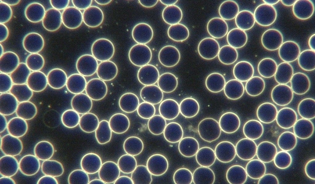 lyn_smulders's tweet photo. @Robstrat27 @holmanm I owe you a big thank you, I'd never heard of Serrapeptase before your tweet. I am convinced it's largely responsible for a massive transformation in my blood over +/- 3 months, as evidenced by live blood analysis. First 2 "before" images in June show rouleaux of RBCs 1/2 https://t.co/zyWrmMG1NI