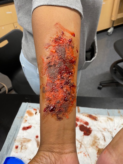 MsG227's tweet photo. 2022 Burn and Wound Lab in Orientation to Health Careers https://t.co/2KGtGTYnY0