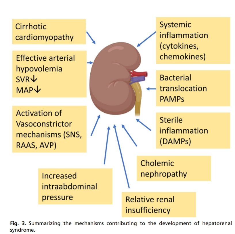 SOMELaguna's tweet photo. Fisiopatologia del Síndrome Hepato-Renal👌🏼

🔰Revisión con todos los mecanismos responsables de la disfunción renal en presencia de enfermedad Hepática severa

https://t.co/CJqm8VRBQD

🔓📃https://t.co/pdXNGW81H8 https://t.co/H68CWUuprL