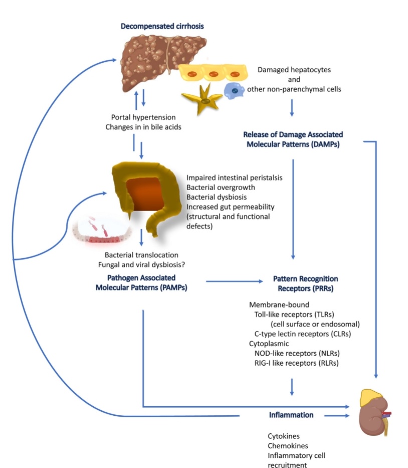 SOMELaguna's tweet photo. Fisiopatologia del Síndrome Hepato-Renal👌🏼

🔰Revisión con todos los mecanismos responsables de la disfunción renal en presencia de enfermedad Hepática severa

https://t.co/CJqm8VRBQD

🔓📃https://t.co/pdXNGW81H8 https://t.co/H68CWUuprL